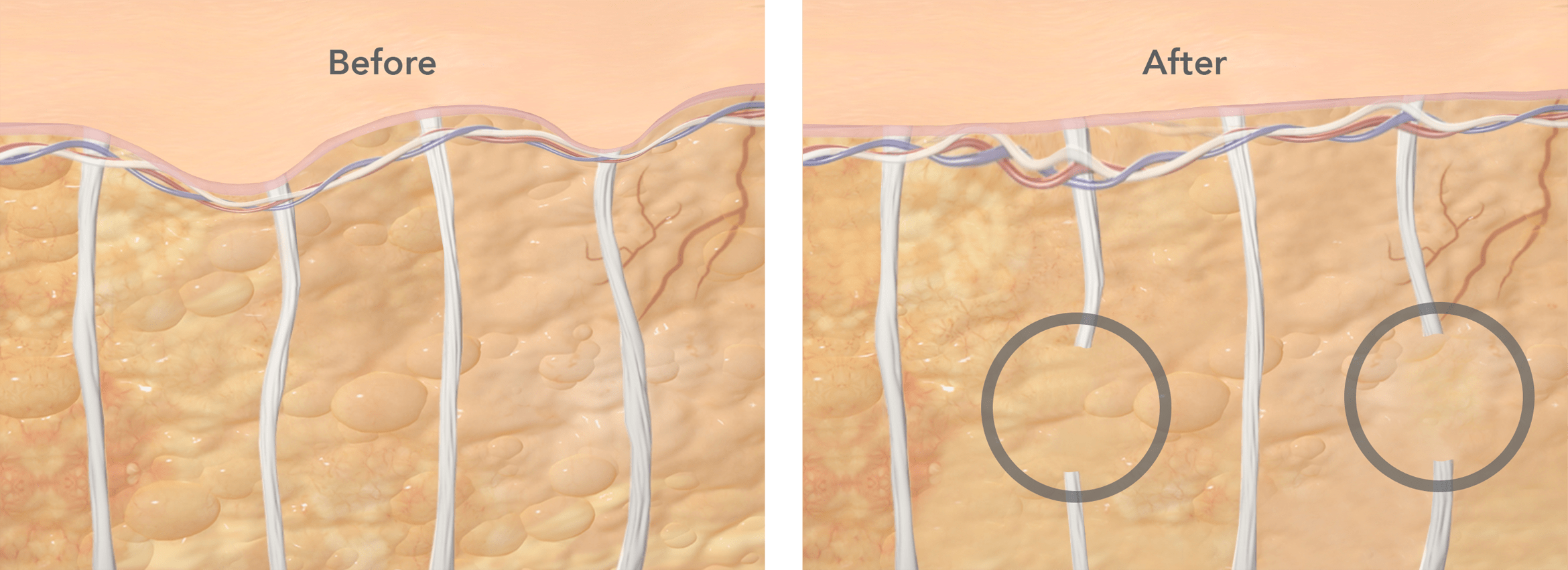 Before and After cross-section